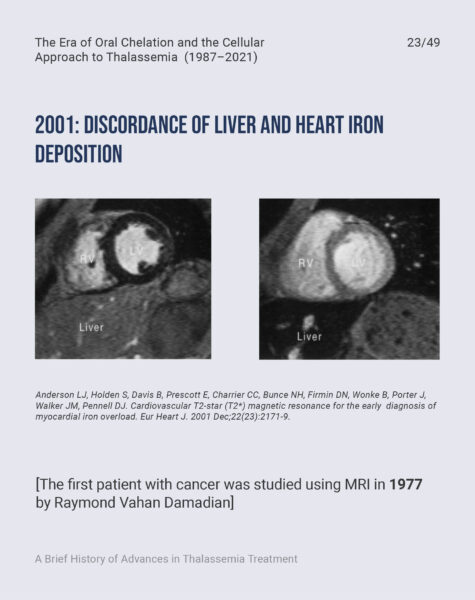 FONDAZIONE-CUTINO-Prof-Maggio-Slide-Workshop-Cambiamento-LinkedIn-Capitolo-323